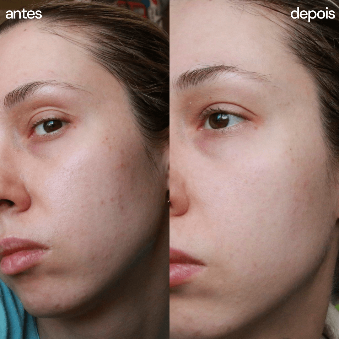 Sérum Facial Hidratação Profunda