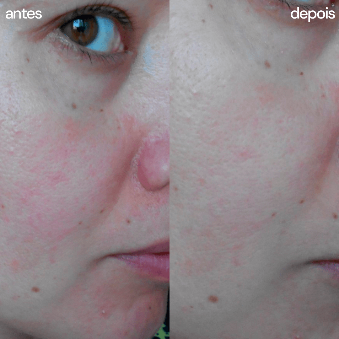 Sérum Facial Reparador Calmante